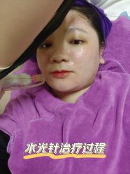 -东莞缔美美容医院