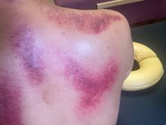 -沈师傅盲人按摩工作室(密三小区店)