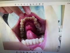 -宁波壹加壹口腔·矫正种植中心