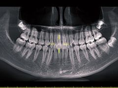 -Dr.Z dental仁康种植矫正中心