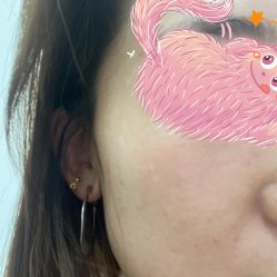 -联合丽格·张菡丽格医疗美容