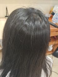 -碧莲盛·不剃发植发