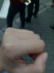 -晶奕空间专业脱毛连锁机构