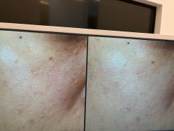 -苑苑vbeauty科技美容SPA