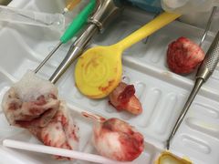 -上海市杨浦区牙病防治所