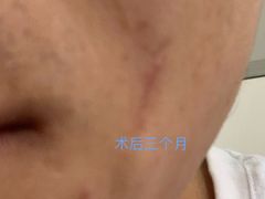 -杭州市第三人民医院