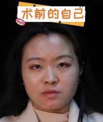 -素美医疗美容·西南眼鼻整形·修复基地