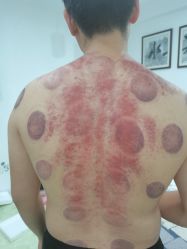 -神农灸道艾灸养生馆