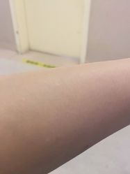 -成都西区医院整形美容