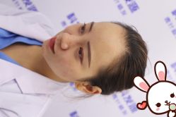 点击看大图 -大麦微针植发丨全国连锁