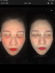 -Deeplus+韩国皮肤管理한국피부관리·C:Lab肌肤实验室