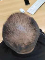 -雍禾植发全国连锁