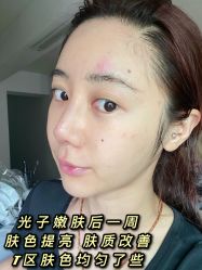 -厦门美莱整形美容医院
