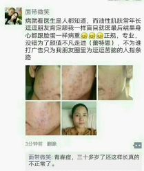 -蕾特恩专业祛痘