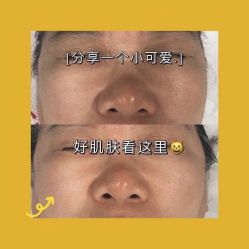 -E.beauty驻颜·痘敏肌调理中心
