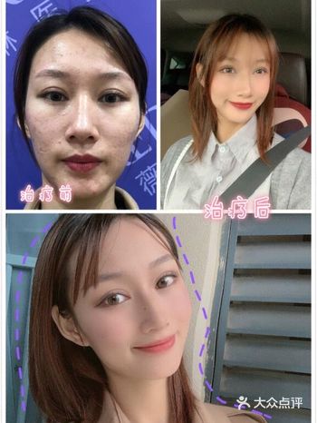 做精致女孩，先管理好你的皮肤