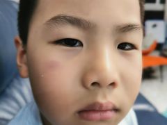 -哥老官重庆美蛙鱼头(圆融广场店)