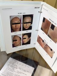 -小梨·OndaPro·专业脱毛连锁机构