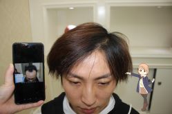 -大麦微针植发丨全国连锁