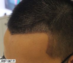 -大麦微针植发丨全国连锁