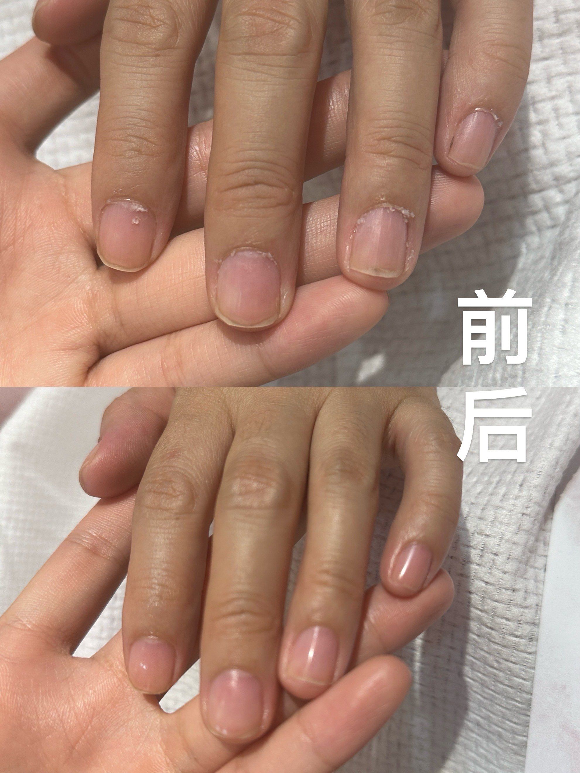 指甲修剪的那些事