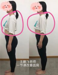 -卓拓普拉提