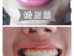 -团圆口腔·种植中心(锦江院区)