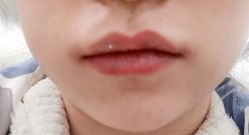 体验后-南京医科大学友谊整形外科医院