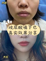-伊丽莎白医疗美容
