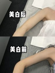 -La Rose·轻奢皮肤管理