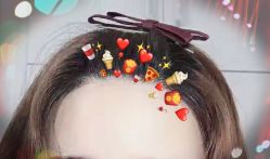 -大麦微针植发全国连锁