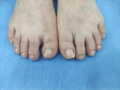 -世龙世家甲沟炎·灰指甲·嵌甲矫正·修脚(武侯区双楠店)