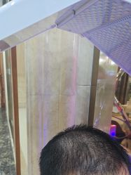 -碧莲盛·不剃发植发