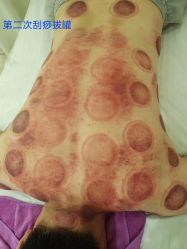 -广生源养发养生馆