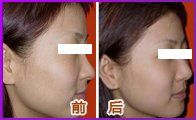 -CMS西美斯·美式医疗美容