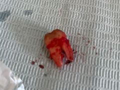 -辽宁省人民医院