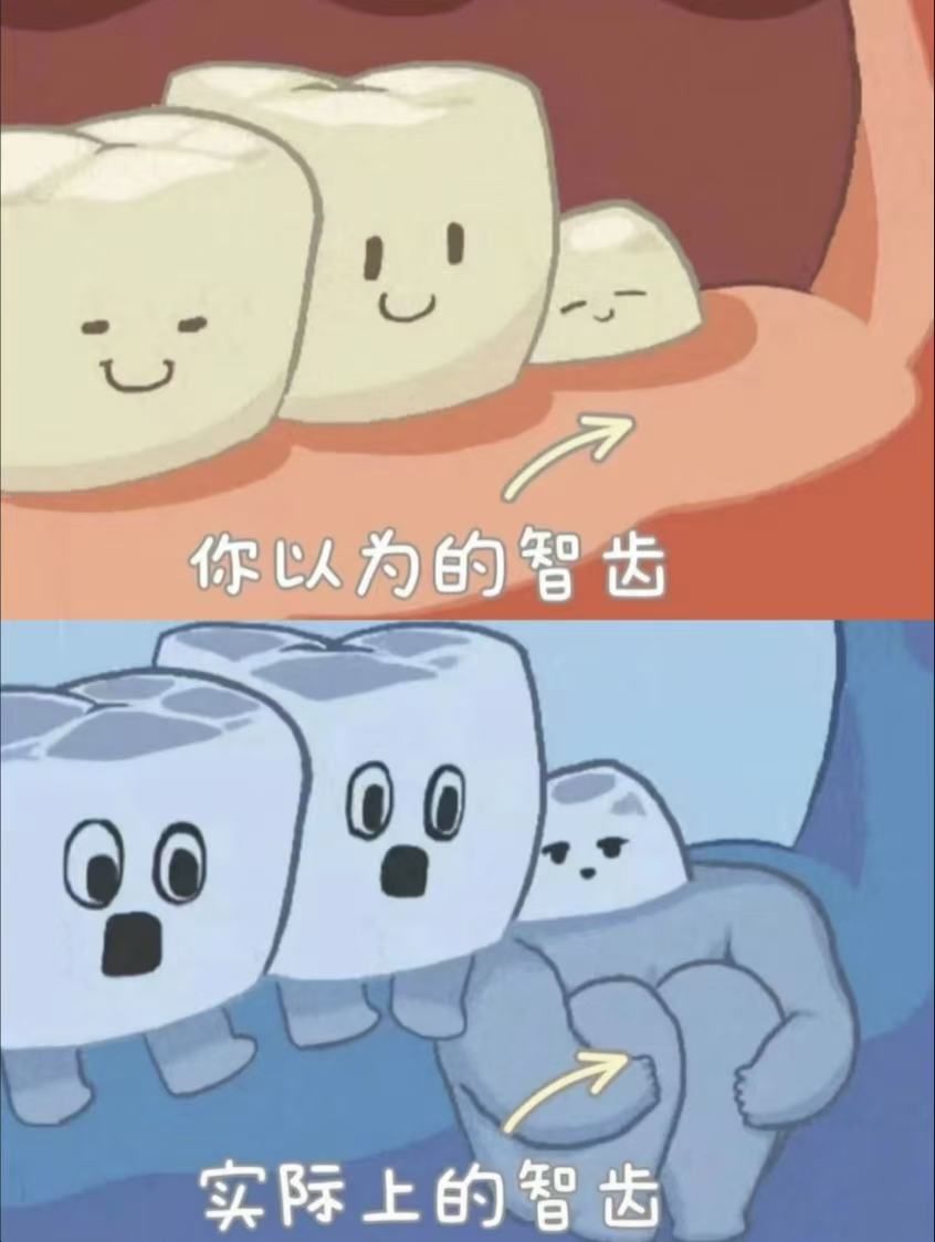 论拔智齿拍片的重要性