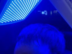 -碧莲盛·不剃发植发