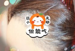 -大麦微针植发全国连锁