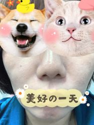 体验后-More摩尔医美の注射线雕光电中心