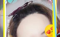 -大麦微针植发全国连锁