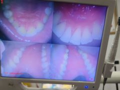 -土豆口腔(凤凰北总店)