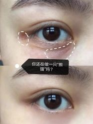 -长沙雅美医疗美容医院