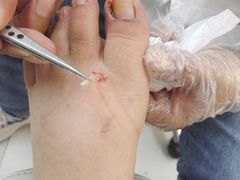 -新甲连锁灰指甲·甲沟炎·鸡眼(黑龙江路店)