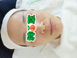 体验前-时光海科学美肤中心