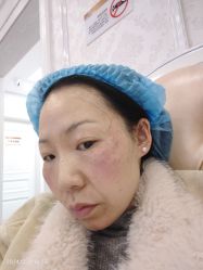 体验前-武汉五洲整形外科医院