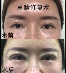 -北京丽星翼美医疗美容