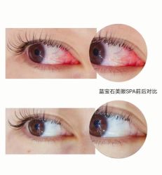 -春田皮肤管理中心品牌旗舰店