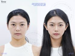 -Yestar艺星整形美容医院