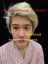 -北京米扬丽格医疗美容·联合丽格鼻整形中心